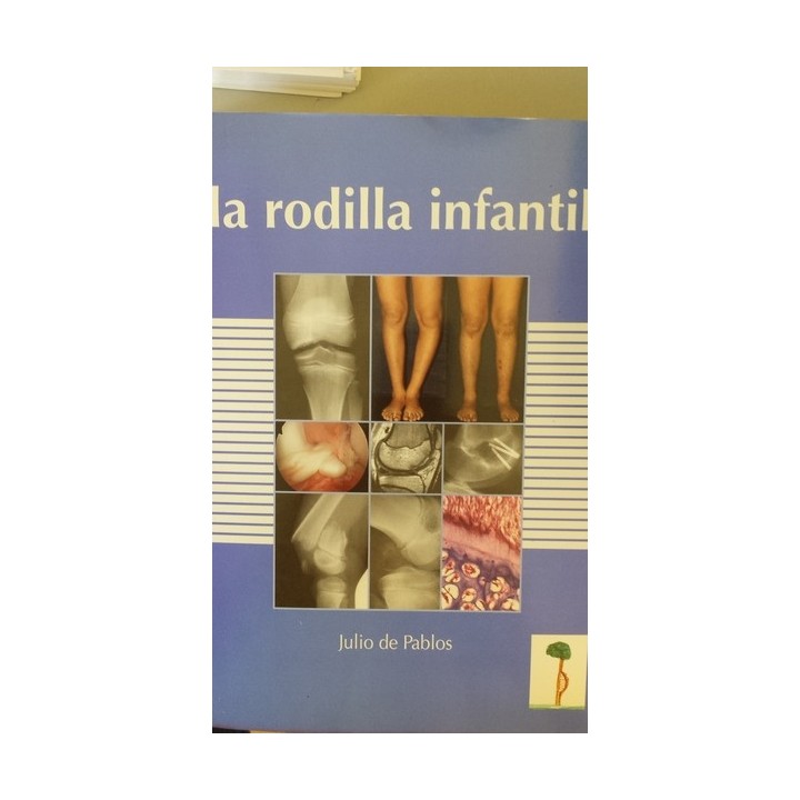 LA RODILLA INFANTIL